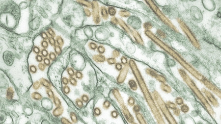 Bloodborne Pathogens Awareness
